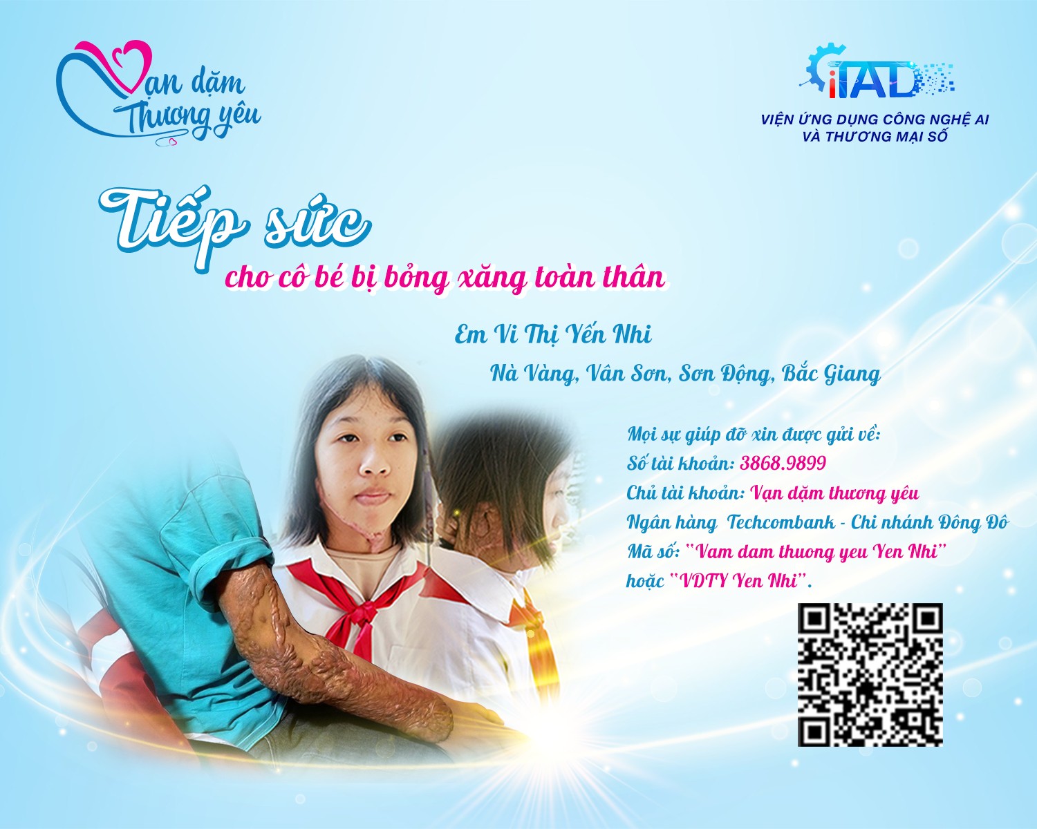 TIẾP SỨC CHO CÔ BÉ BỊ BỎNG XĂNG TOÀN THÂN